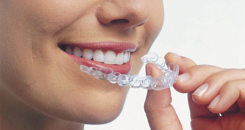 a close up of a woman holding an Invisalign aligner up to her mouth